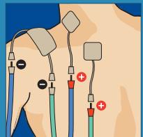 COMPEX THETA STIM - 26