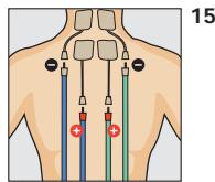 COMPEX THETA STIM - Programme recommende Capillarisation - 2