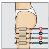 COMPEX THETA STIM - FESSES ET CUISSES - 3