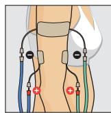 COMPEX THETA STIM - ESTHETIQUE - 1