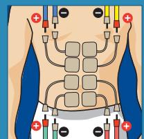 COMPEX THETA STIM - 1