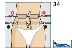COMPEX THETA STIM - Placement des electrodes et position du corps - 3