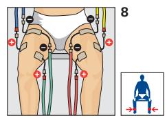 COMPEX THETA STIM - Placement des electrodes - 1