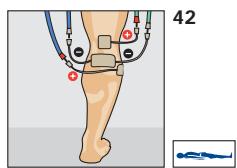 COMPEX THETA STIM - Pour un sujet représentant des douleurs dans les muscles des jambes uniquement à la marche (absence de douleur au repos) - 1