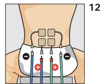 COMPEX THETA STIM - Position du corps - 1
