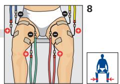 COMPEX THETA STIM - REHABILITATION - 1