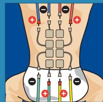 COMPEX THETA STIM - 10