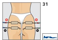 COMPEX THETA STIM - BRAS - 3