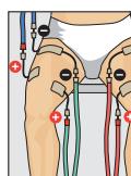 COMPEX THETA STIM - FITNESS - 1