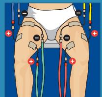 COMPEX THETA STIM - 22