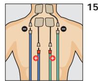 COMPEX THETA STIM - ANTALGIQUE - 1