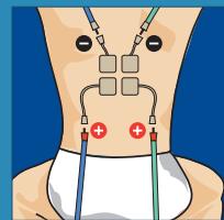 COMPEX THETA STIM - 8