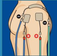 COMPEX THETA STIM - 12