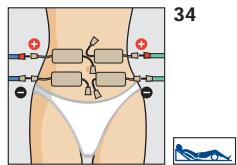 COMPEX THETA STIM - Placement des electrodes et position du corps - 1