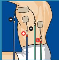 COMPEX THETA STIM - 14
