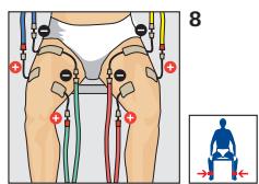 COMPEX THETA STIM - Placement des electrodes - 1