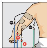 COMPEX THETA STIM - Position du corps - 1