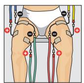 COMPEX THETA STIM - FESSES - 3