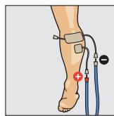 COMPEX THETA STIM - Position du corps - 1