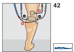 COMPEX THETA STIM - Traitement de l'insuffisance arterielle - 1