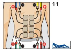 COMPEX THETA STIM - Durée du traitement - 3