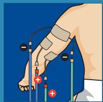 COMPEX THETA STIM - 16