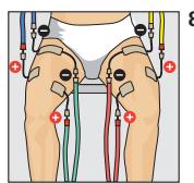 COMPEX THETA STIM - Placement des electrodes et position du corps - 1