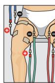 COMPEX THETA STIM - Catégorie Sport - 1