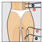 COMPEX THETA STIM - Programme recommende Lombalgle - 1