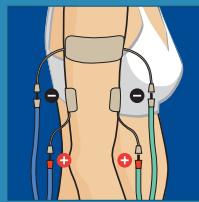 COMPEX THETA STIM - 18