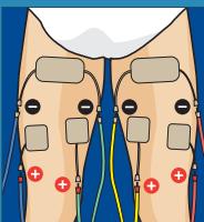 COMPEX THETA STIM - 4