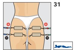 COMPEX THETA STIM - Programme recommende Adipostress - 2