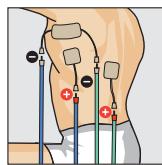 COMPEX THETA STIM - Position du corps - 1