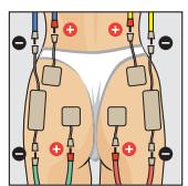 COMPEX THETA STIM - Position du corps - 1