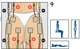 COMPEX THETA STIM - BRAS - 3