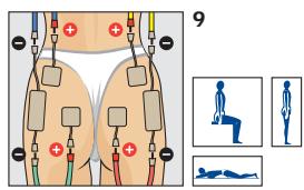 COMPEX THETA STIM - Placement des electrodes et position du corps - 1