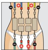 COMPEX THETA STIM - et position du corps - 1
