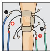 COMPEX THETA STIM - Catégore Antalgique - 1