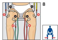 COMPEX THETA STIM - Placement des electrodes et position du corps - 1