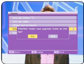 OPTEX ORT 8791 - 1.3) Effacer tous les favoris - 1