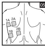 SANITAS DIGITAL EMS TENS - 3