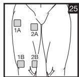 SANITAS DIGITAL EMS TENS - 23