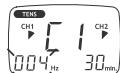 SANITAS DIGITAL EMS TENS - Secuencia de los programas TENS/EMS 11 hasta 20 (programas individuales) - 3