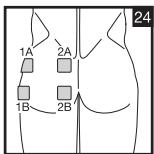 SANITAS DIGITAL EMS TENS - 22