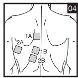 SANITAS DIGITAL EMS TENS - 2