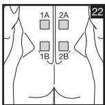 SANITAS DIGITAL EMS TENS - 20