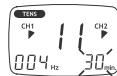 SANITAS DIGITAL EMS TENS - Ablauf für die TENS/EMS-Programme 11 bis 20 (Individual-Programme) - 4