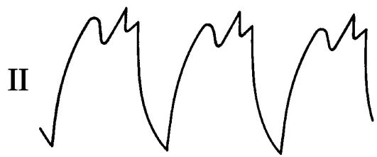 LADA NIVA - Contrôle de l'alternateur à l'aide d'un oscillographe électronique - 2