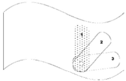 AB TRONIC X2 - Positionnement des tampons du canal arrêté : - 1