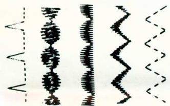 MERRITT 159 - Exécution de points d'ornament (Modèle 158 seulement) - 1